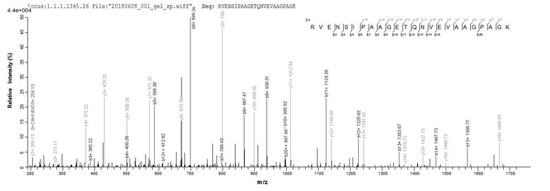 Based on the SEQUEST from database of E.coli host and target protein, the LC-MS/MS Analysis result of this product could indicate that this peptide derived from E.coli-expressed Homo sapiens (Human) SART3.Recombinant Human Squamous Cell Carcinoma Antigen Recognized By T-Cells 3 (SART3) Protein (His-SUMO)