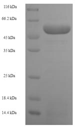 Greater than 90% as determined by SDS-PAGE.Recombinant Human Squamous Cell Carcinoma Antigen Recognized By T-Cells 3 (SART3) Protein (His-SUMO)