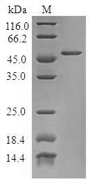 Greater than 90% as determined by SDS-PAGE.Recombinant Human Tumor Protein D53 (TPD52L1) Protein (GST)