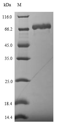 Greater than 90% as determined by SDS-PAGE.Recombinant Influenza A Virus Nucleoprotein (NP) Protein (His-SUMO)
