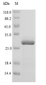 Greater than 90% as determined by SDS-PAGE.