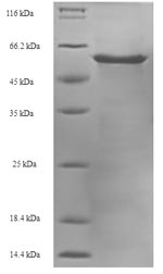Greater than 90% as determined by SDS-PAGE.Recombinant Bovine Heterogeneous Nuclear Ribonucleoproteins A2/B1 (HNRNPA2B1) Protein (His-SUMO)