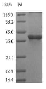 Greater than 90% as determined by SDS-PAGE.