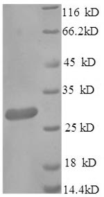 Greater than 90% as determined by SDS-PAGE.Recombinant Mouse Scavenger Receptor Cysteine-Rich Type 1 Protein M130 (CD163) Protein (His)