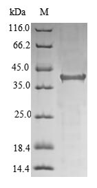 Greater than 85% as determined by SDS-PAGE.Recombinant Human Hereditary Hemochromatosis Protein (HFE) Protein (His&Myc)