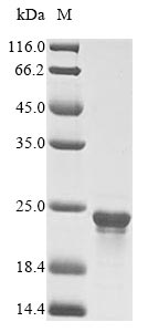Greater than 85% as determined by SDS-PAGE.Recombinant Cyanophora Paradoxa Chaperone Protein Dnak (DNAK-A) Protein (His&Myc)