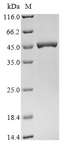 Greater than 90% as determined by SDS-PAGE.Recombinant Mouse E3 Ubiquitin-Protein Ligase Trim63 (TRIM63) Protein (His&Myc)