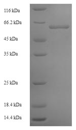 Greater than 90% as determined by SDS-PAGE.Recombinant Arabidopsis Thaliana Lycopene Beta Cyclase, Chloroplastic (LCY1) Protein (His-SUMO)