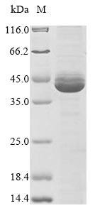 Greater than 85% as determined by SDS-PAGE.Recombinant Epstein-Barr Virus Replication And Transcription Activator (BRLF1) Protein (His&Myc)