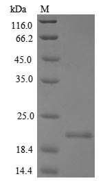 Greater than 85% as determined by SDS-PAGE.Recombinant Mouse Allergin-1 (MILR1) Protein (His&Myc)