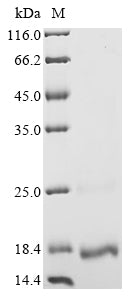 Greater than 90% as determined by SDS-PAGE.Recombinant Human Girdin (CCDC88A) Protein (His)