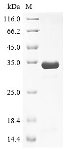 Greater than 85% as determined by SDS-PAGE.Recombinant Mouse Olfactomedin-4 (OLFM4) Protein (His)