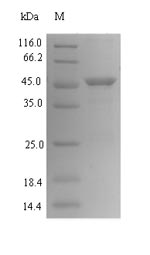 Greater than 90% as determined by SDS-PAGE.Recombinant Helicobacter Pylori Vacuolating Cytotoxin Autotransporter (VACA) Protein (His-SUMO)
