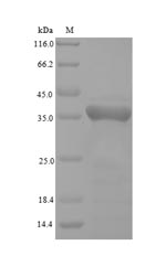 Greater than 90% as determined by SDS-PAGE.Recombinant Pongo Pygmaeus Phospholipid Hydroperoxide Glutathione Peroxidase (GPX4) Protein (His-SUMO)