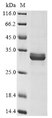 Greater than 85% as determined by SDS-PAGE.Recombinant E.Coli Cytolethal Distending Toxin Subunit A (CDTA) Protein (His)