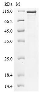 Greater than 85% as determined by SDS-PAGE.Recombinant Bordetella Pertussis Brka Autotransporter (BRKA) Protein (His&Myc)