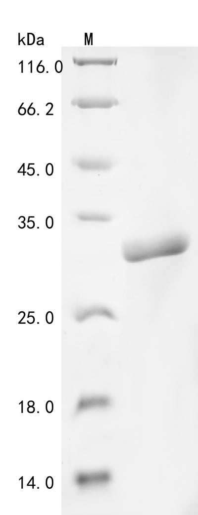 Greater than 90% as determined by SDS-PAGE.Recombinant Clostridium Perfringens Protein Hypa (HYPA) Protein (His&Myc)