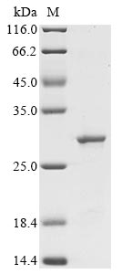 Greater than 90% as determined by SDS-PAGE.Recombinant E.Coli Cytolethal Distending Toxin Subunit C (CDTC) Protein (His&Myc)