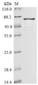 Greater than 85% as determined by SDS-PAGE.Recombinant Human Filamin A-Interacting Protein 1-Like (FILIP1L) Protein (His-GST)