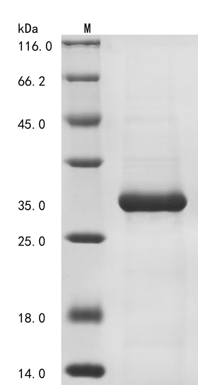 Greater than 85% as determined by SDS-PAGE.Recombinant Human Filamin A-Interacting Protein 1-Like (FILIP1L) Protein (His)