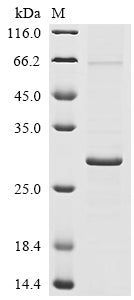 Greater than 85% as determined by SDS-PAGE.Recombinant Human Coronavirus Hku1 Protein I (N) Protein (His&Myc)