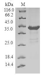 Greater than 90% as determined by SDS-PAGE.Recombinant Human Pleckstrin Homology-Like Domain Family A Member 2 (PHLDA2) Protein (GST)