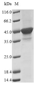 Greater than 85% as determined by SDS-PAGE.Recombinant Dictyostelium Discoideum Dna-Dependent Protein Kinase Catalytic Subunit (DNAPKCS) Protein (His&Myc)