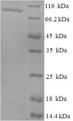Greater than 90% as determined by SDS-PAGE.Recombinant Human Inactive N-Acetylated-Alpha-Linked Acidic Dipeptidase-Like Protein 2 (NAALADL2) Protein (His-SUMO)