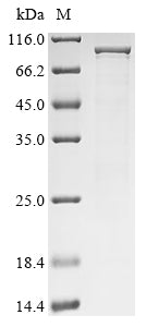 Greater than 85% as determined by SDS-PAGE.Recombinant Mouse Endoribonuclease Zc3H12A (ZC3H12A) Protein (His)