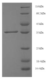 Greater than 90% as determined by SDS-PAGE.Recombinant Human Single-Strand Selective Monofunctional Uracil Dna Glycosylase (SMUG1) Protein (His-SUMO)