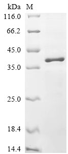 Greater than 85% as determined by SDS-PAGE.Recombinant Mouse 5-Amp-Activated Protein Kinase Catalytic Subunit Alpha-1 (PRKAA1) Protein (His)