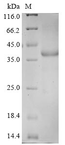 Greater than 85% as determined by SDS-PAGE.Recombinant Human Coronavirus Hku1 Spike Glycoprotein (S) Protein (His)