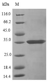 Greater than 85% as determined by SDS-PAGE.Recombinant Mouse C-Type Lectin Domain Family 12 Member A (CLEC12A) Protein (His&Myc)