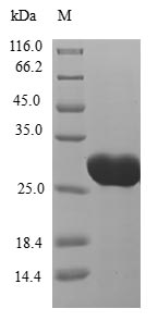 Greater than 90% as determined by SDS-PAGE.Recombinant Human Kita-Kyushu Lung Cancer Antigen 1 (CT83) Protein (His-B2M)