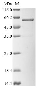 Greater than 90% as determined by SDS-PAGE.Biotinylated Recombinant Human Kita-Kyushu Lung Cancer Antigen 1 (CT83) Protein (MBP&His-Avi)