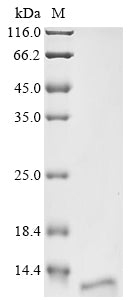 Greater than 90% as determined by SDS-PAGE.Recombinant Human Kita-Kyushu Lung Cancer Antigen 1 (CT83) Protein (His)