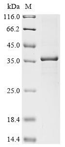 Greater than 85% as determined by SDS-PAGE.Recombinant Rat 17-Beta-Hydroxysteroid Dehydrogenase 13 (HSD17B13) Protein (His)