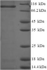 Greater than 90% as determined by SDS-PAGE.