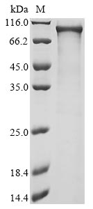 Greater than 85% as determined by SDS-PAGE.Recombinant Human Activating Transcription Factor 7-Interacting Protein 2 (ATF7IP2) Protein (His)