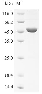 Greater than 90% as determined by SDS-PAGE.Recombinant Mouse Neuronal Pentraxin-1 (NPTX1) Protein (His)