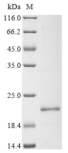 Greater than 90% as determined by SDS-PAGE.