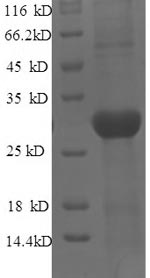 Greater than 90% as determined by SDS-PAGE.Recombinant Mouse Tyrosine-Protein Kinase Jak3 (JAK3) Protein (His)
