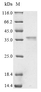 Greater than 85% as determined by SDS-PAGE.Recombinant Rat Myosin-9 (MYH9) Protein (His&Myc)