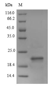 Greater than 90% as determined by SDS-PAGE.Recombinant Mouse Lymphocyte Antigen 6E (LY6E) Protein (His-B2M)