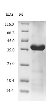 Greater than 85% as determined by SDS-PAGE.Recombinant Desulfotalea Psychrophila Dna Ligase (LIGA) Protein (His)