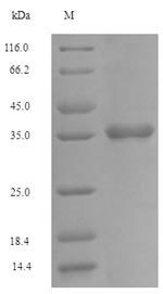 Greater than 90% as determined by SDS-PAGE.Recombinant Human Fc Receptor-Like Protein 6 (FCRL6) Protein (His)