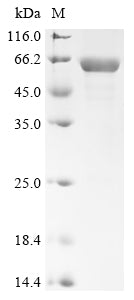 Greater than 85% as determined by SDS-PAGE.Recombinant Mouse Retinal Dehydrogenase 2 (ALDH1A2) Protein (His)