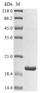 Greater than 85% as determined by SDS-PAGE.Recombinant Pan Troglodytes Histone Demethylase Uty (UTY) Protein (His&Myc)
