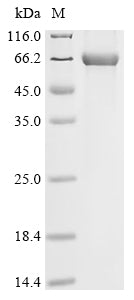 Greater than 85% as determined by SDS-PAGE.Recombinant Human Leucine-Rich Repeat Serine/Threonine-Protein Kinase 2 (LRRK2) Protein (His)