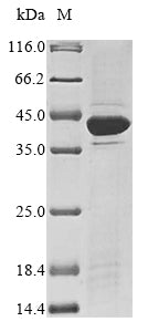Greater than 85% as determined by SDS-PAGE.Recombinant Rat Zinc-Alpha-2-Glycoprotein (AZGP1) Protein (His&Myc)